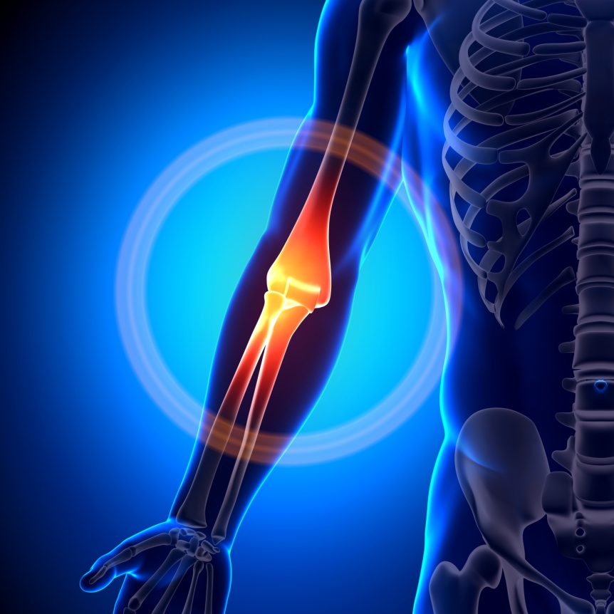 Elbow 1 elbow skeleton highlight