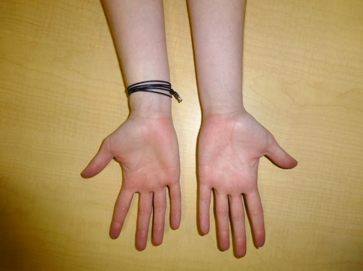Wrist & Hand 3 hand stretch