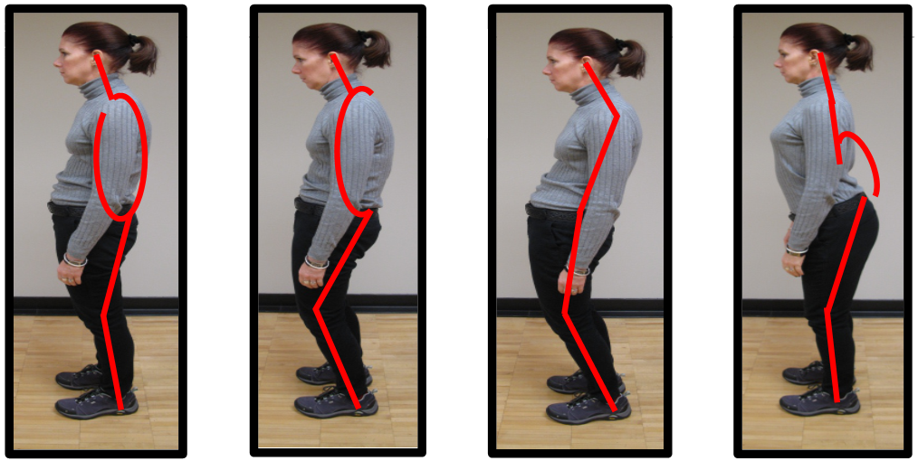 Abdominal & Core 26 bad core posture