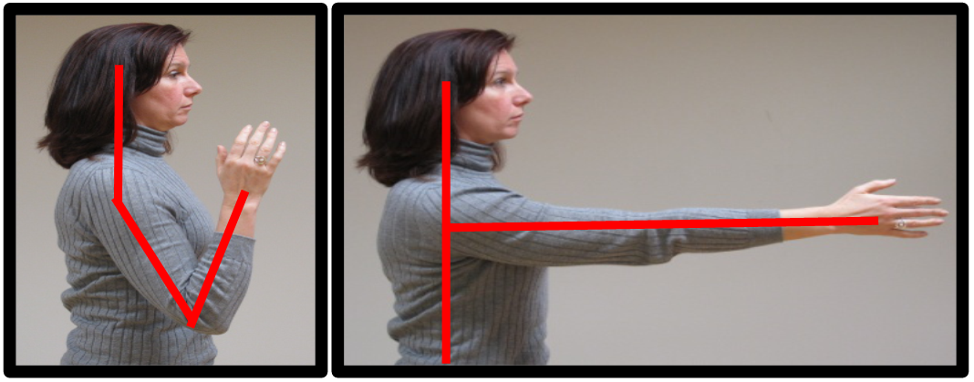 Elbow 17 bad elbow posture