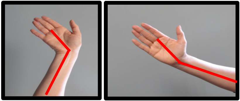 Wrist & Hand 18 bad wrist posture