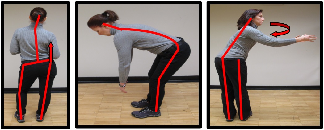 bad hip posture