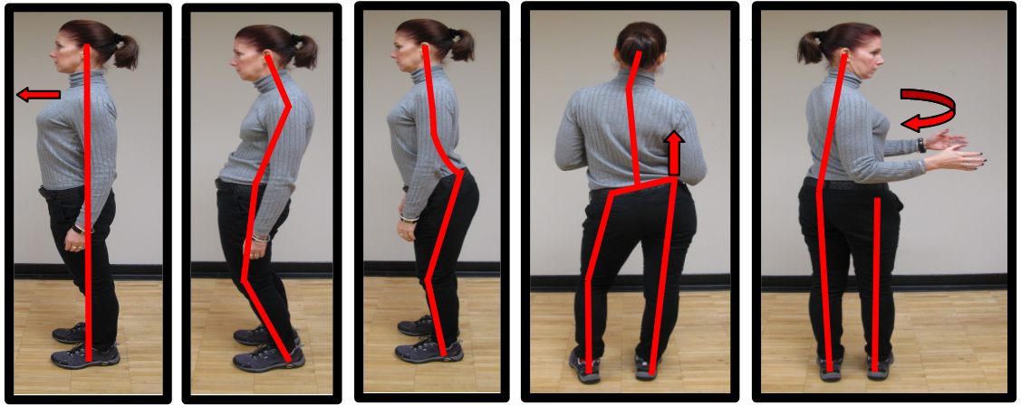 Lower Back 19 bad lower back posture